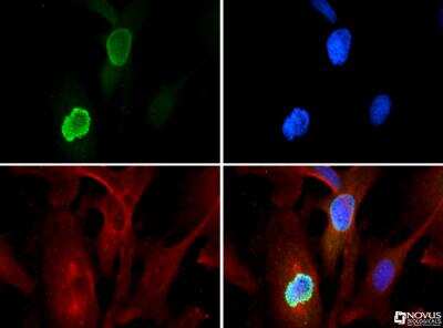 Immunocytochemistry/ Immunofluorescence: Histone H3 [Trimethyl Lys56] Antibody - BSA Free [NB21-1343]